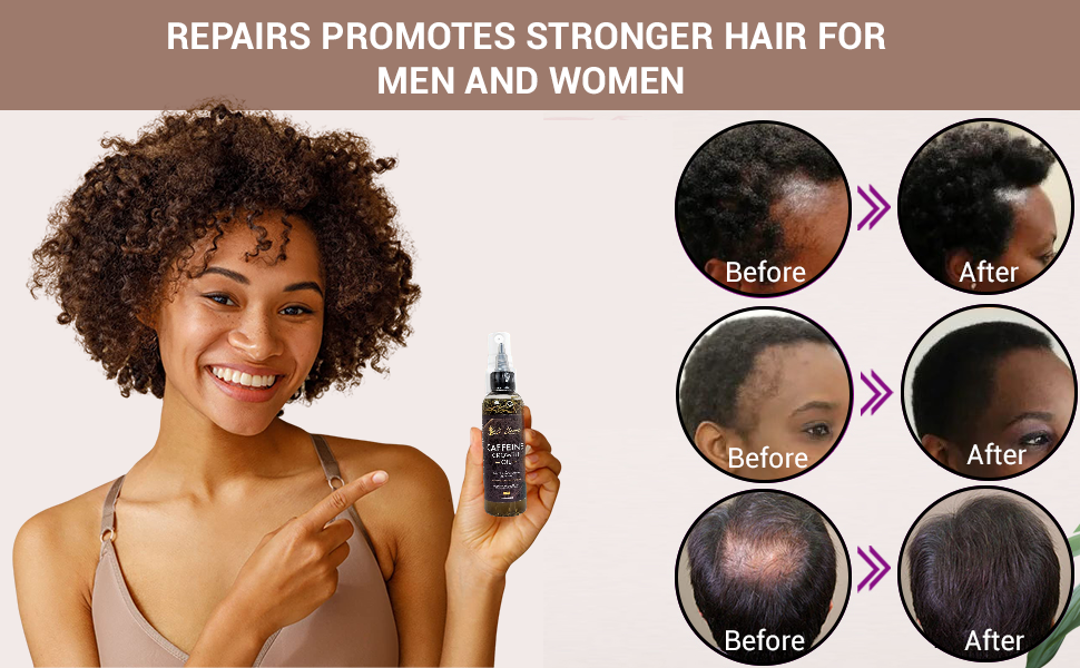 Caffeine Hair Growth Oil 2oz, Herbs, Biotin, Essential oils For All